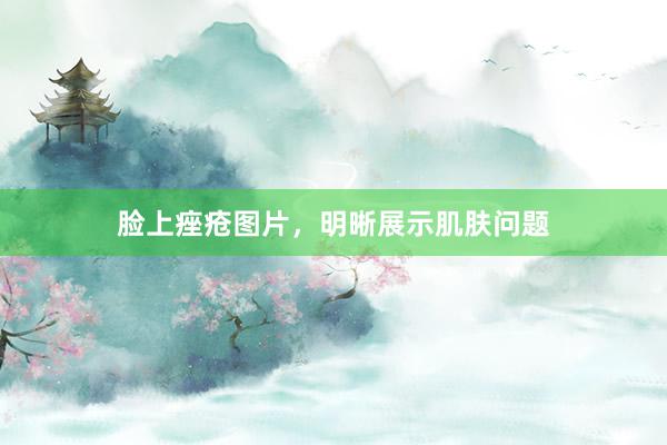 脸上痤疮图片，明晰展示肌肤问题
